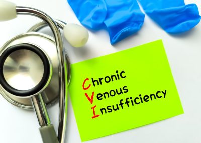 Chronic,Venous,Insufficiency,Or,Cvi,,A,Medical,Condition,Characterized,By