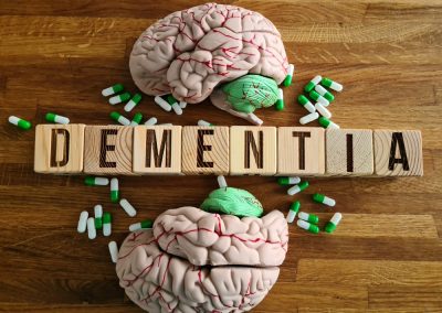 Human,Head,Brain,Anatomy,With,The,Word,Dementia,And,Pills.